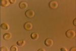 Erythropoieisis and Erythropoietin