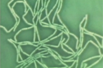 Selected Lactobacillus Strain Shirota