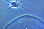 OTEOCYTE